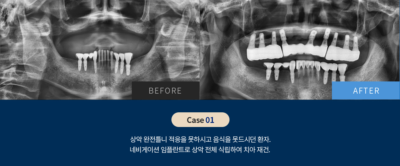 비포 애프터 이미지